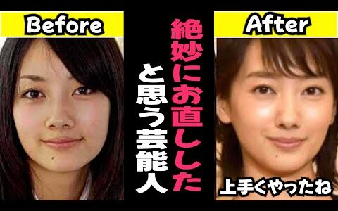 【ガルちゃん芸能】絶妙にお直ししたと思う芸能人まとめ【有益】